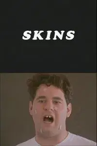 Skins